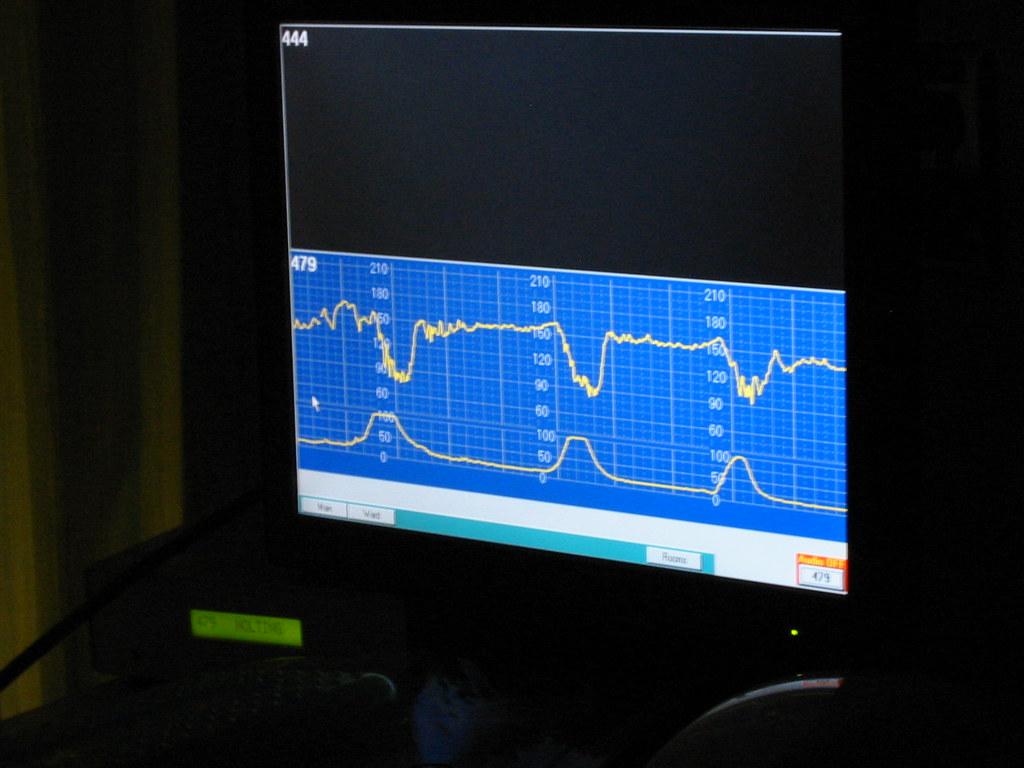 Understanding Your Needs Choosing the Right Heart Rate Monitor