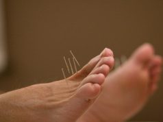 How Acupuncture Can Help Relieve Chronic Pain How Acupuncture Can Help Relieve Chronic Pain