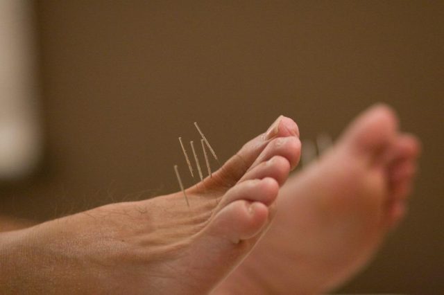 How Acupuncture Can Help Relieve Chronic Pain