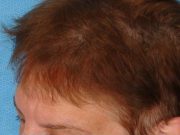 Best Supplements for Hair, Skin, and Nails Best Supplements for Hair, Skin, and Nails