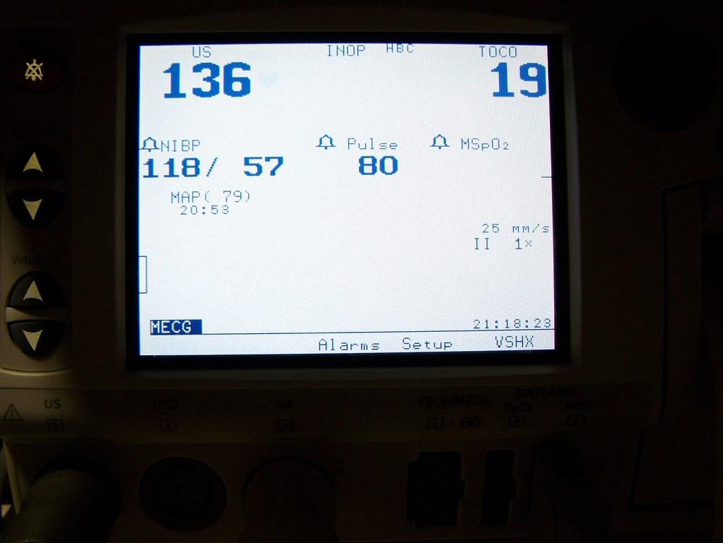 How to‌ Maintain and Track Your ‍Blood‍ Pressure Effectively