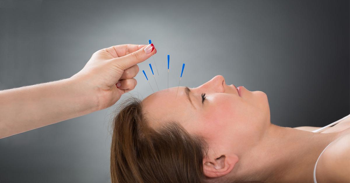 Identifying the Types of Chronic Pain That Respond Well to Acupuncture Treatment